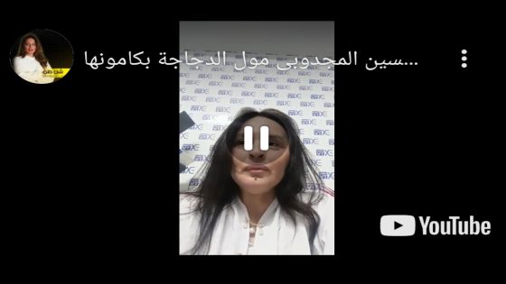 الحسين المجدوبي مول الدجاجة بكامونها